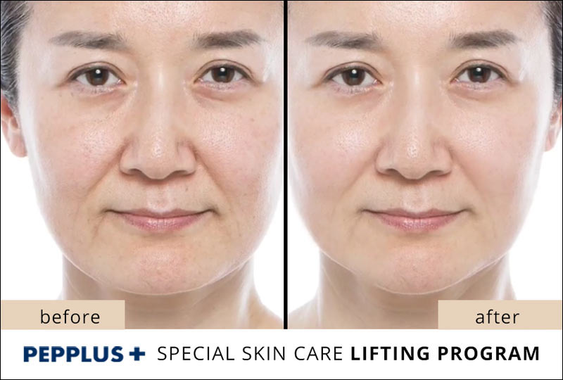 PicoBio PEPPLUS+ SUPER Lifting Program – 10 treatments & wrinkle cream