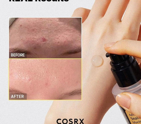 Advanced Snail 96 Mucin Power Essence - Kahng