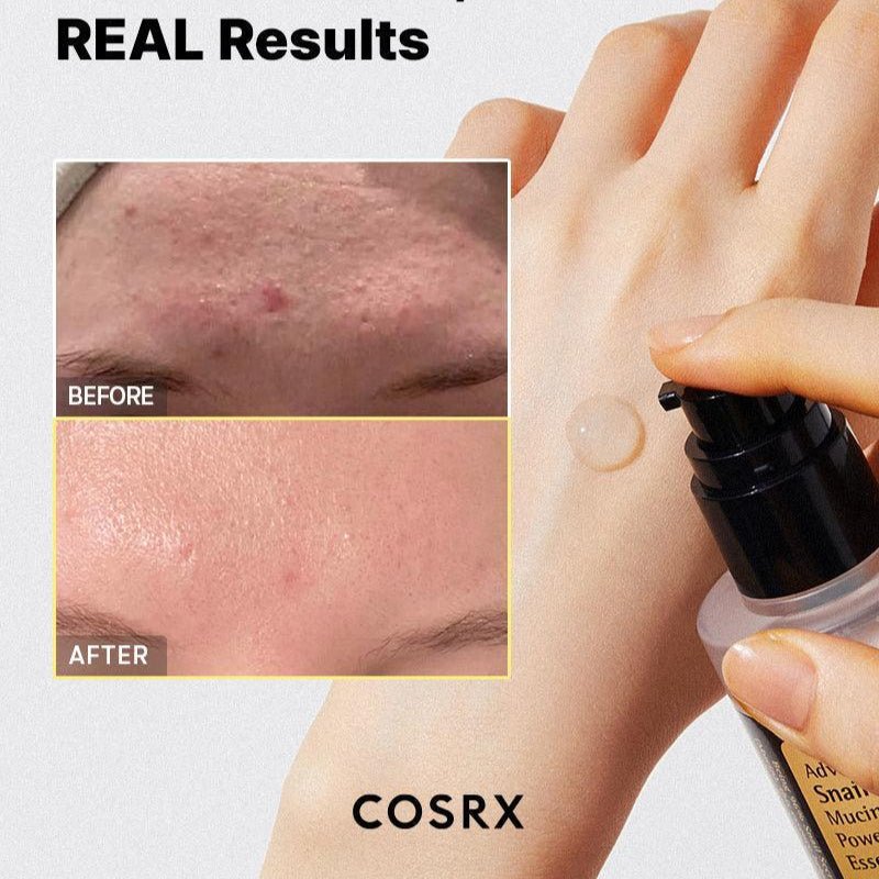 Advanced Snail 96 Mucin Power Essence - Kahng