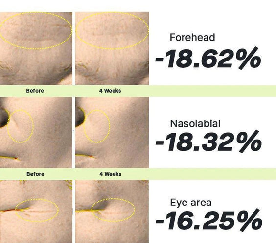 The Retinol 0.1 Cream - Kahng